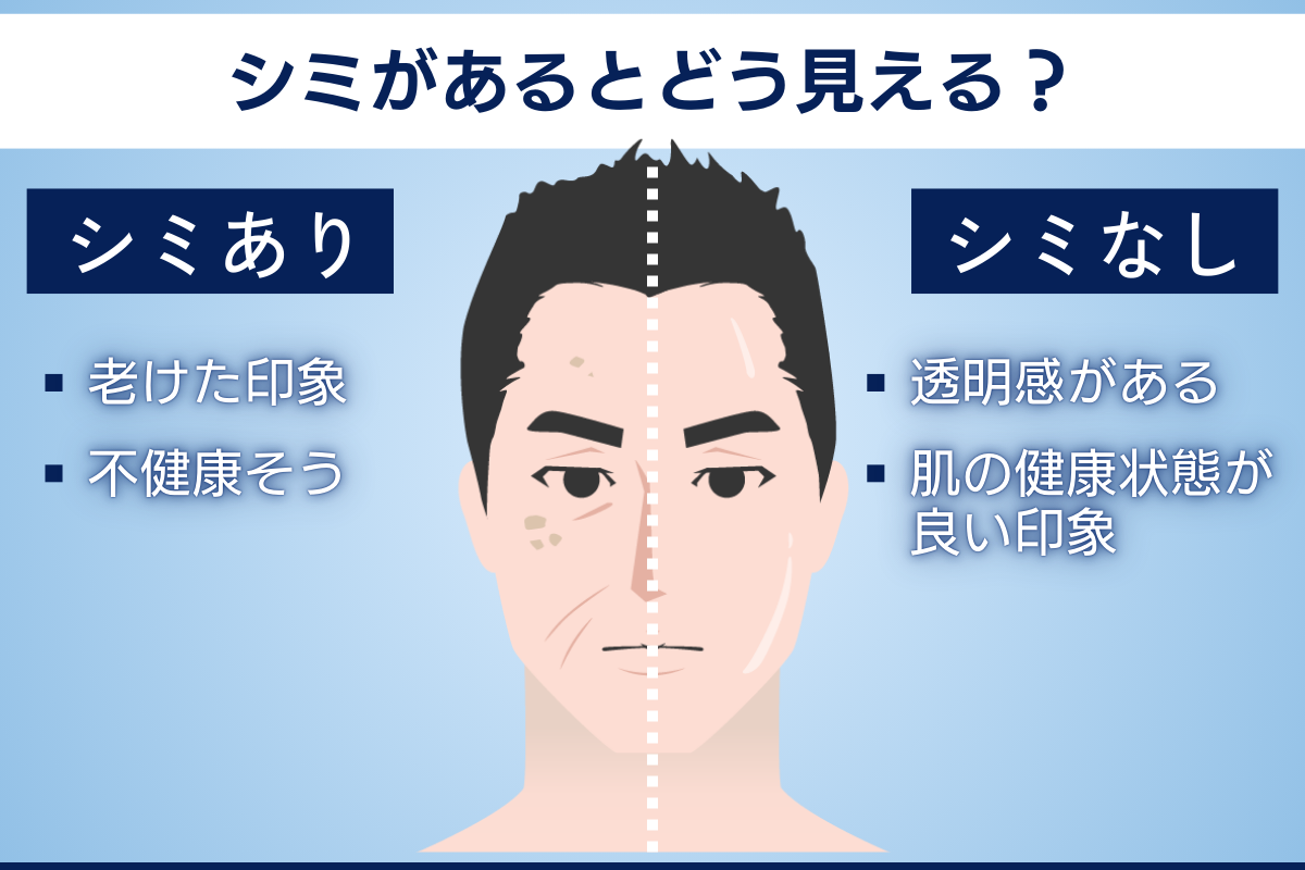 メンズのシミが与える印象とその影響