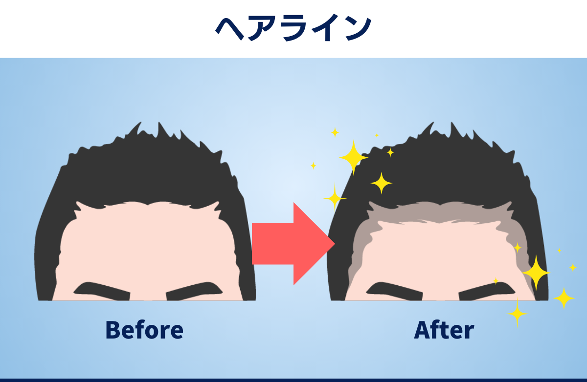 メンズ　ヘアライン