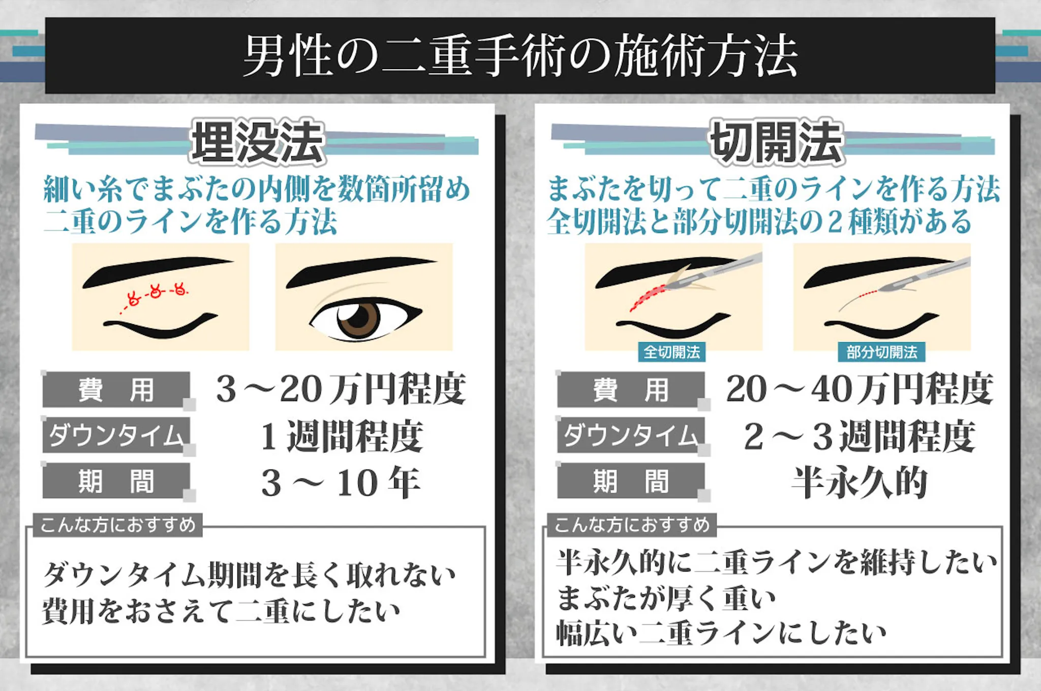 メンズ　二重整形　おすすめ